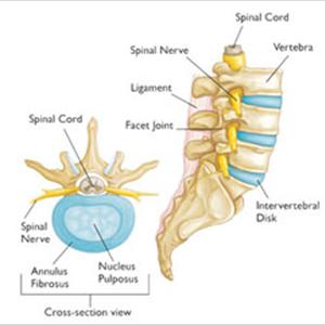 Symptoms Of Sciatic Injury - Sciatica: Cause And Diagnosis